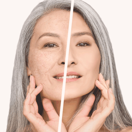 Laser & RF Treatments Aurora Medi Spa & Plastic Surgery