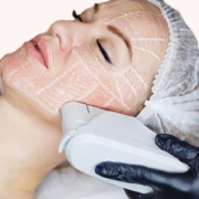 b ultherapy birmingham, mi