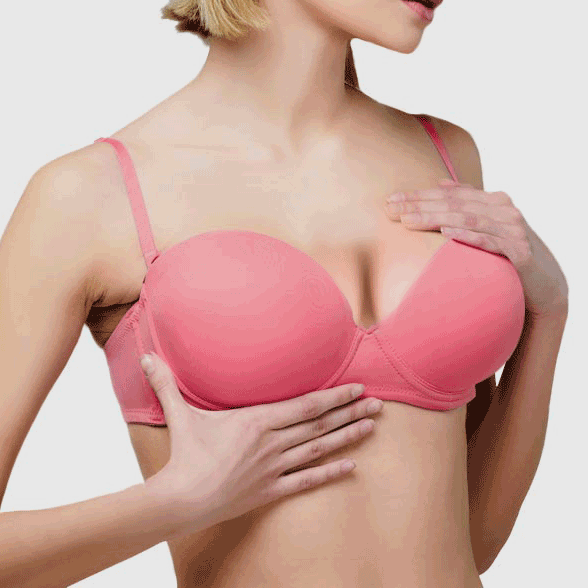 breast augmentation
