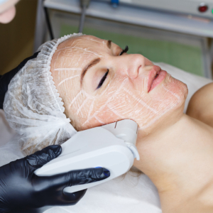 ultherapy2