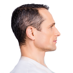 male nonsurgical necklift