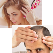 hair transplant east lansing