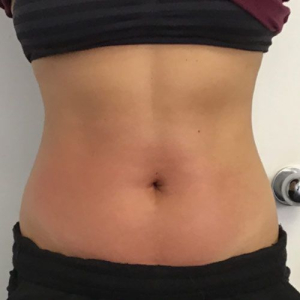 bliss 6 after bliss 6 after