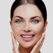 pigment treatment lansing